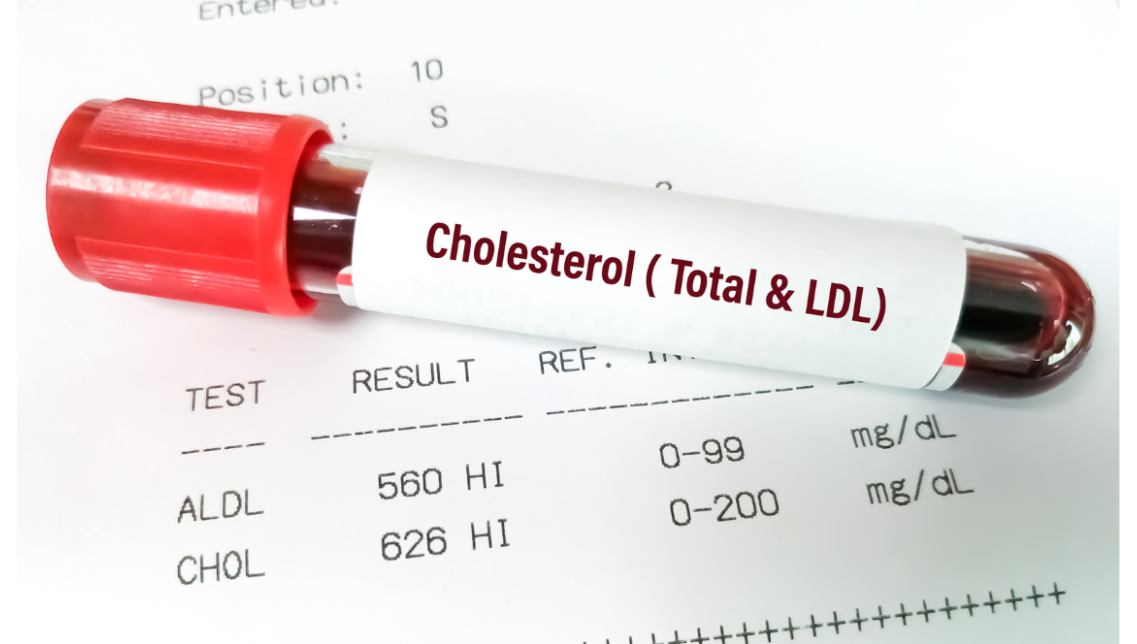 colesterolo: come riconoscerlo, controllarlo e prevenirne gli effetti