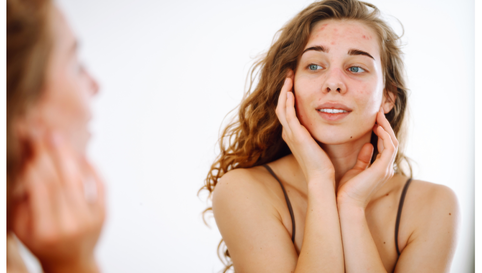 Pelle secca e screpolata: routine completa per proteggerla in inverno Pelle secca e screpolata: routine completa per proteggerla in inverno