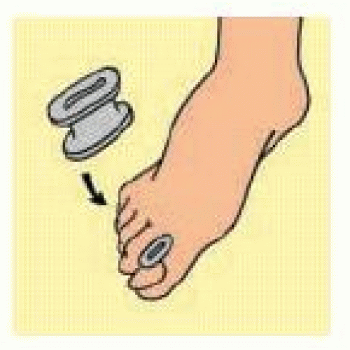 S016LF GEL TOE SEPA DIV DITA L