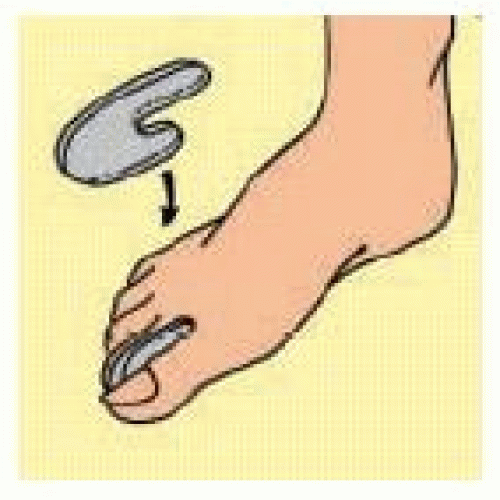 S017SF GEL TOE SPRE DIS DITA S